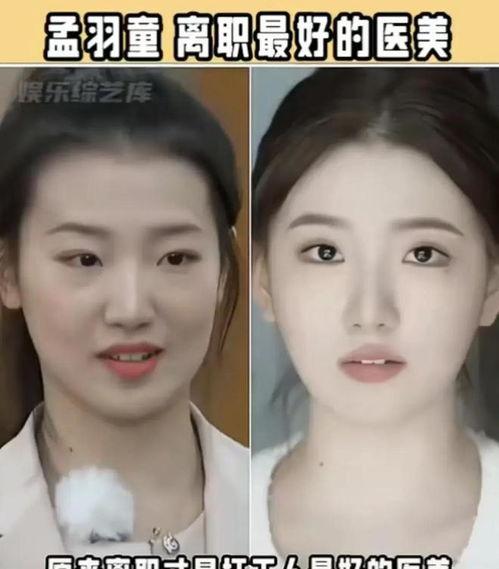 整形视频,美丽蜕变背后的秘密与技巧