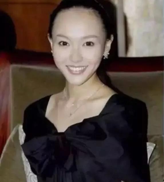 有发际线的明星,揭秘明星们的发际线秘密