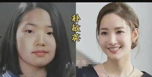 韩国明星整容前后照片,惊人蜕变背后的秘密